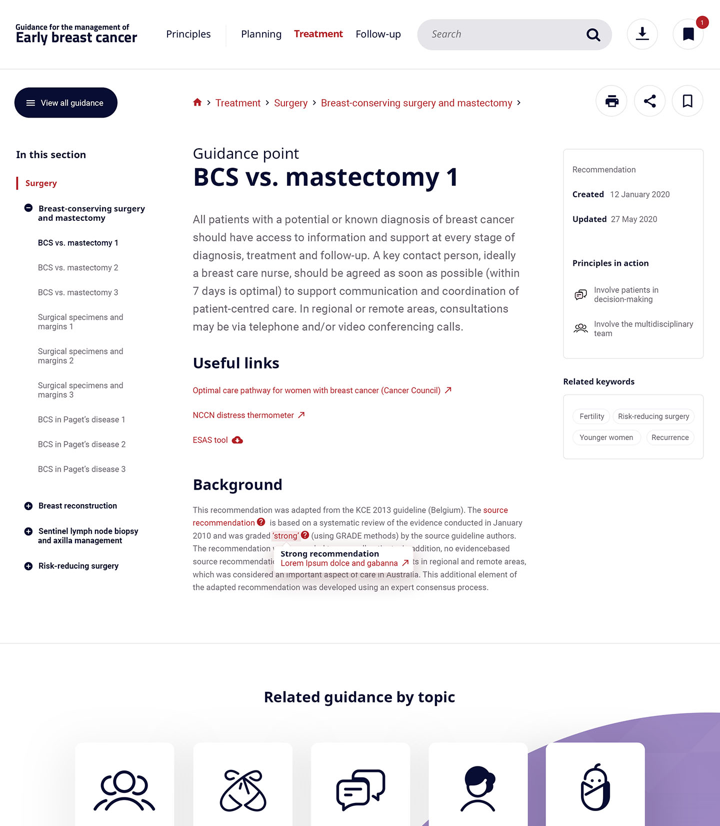 Management of Early Stage Breast Cancer website